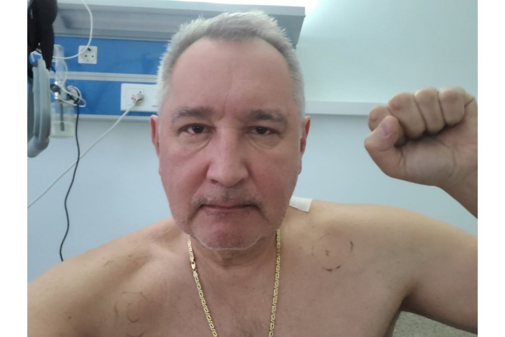  рогозин выложил первое постоперационное фото 