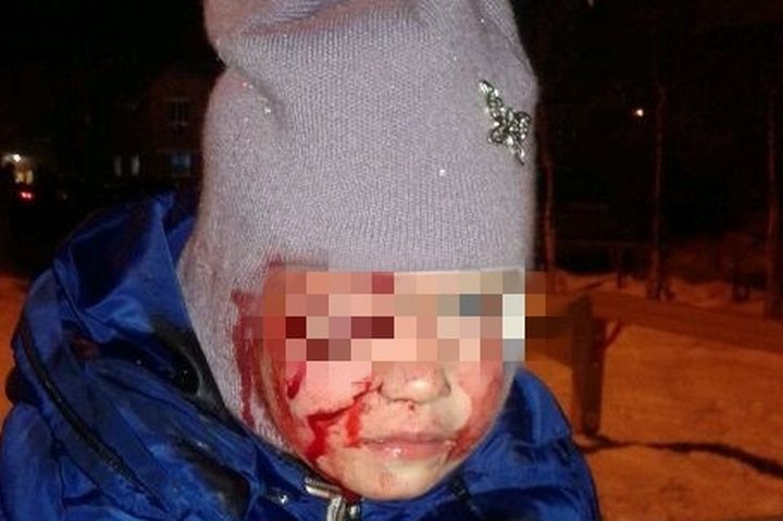  свердловском городе овчарка напала четырехлетнюю девочку 