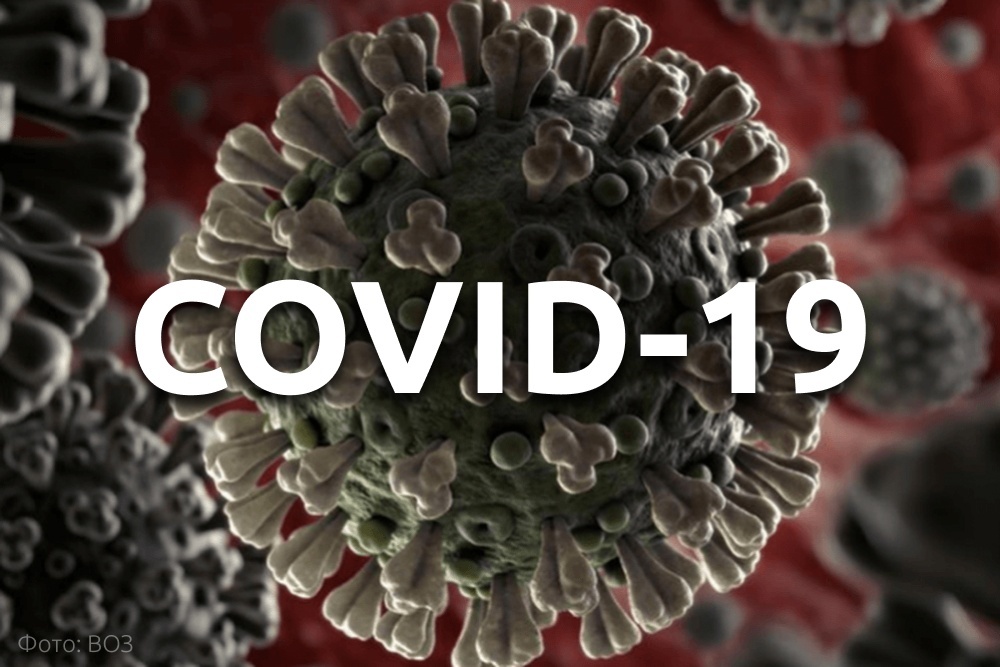      COVID-19 -  