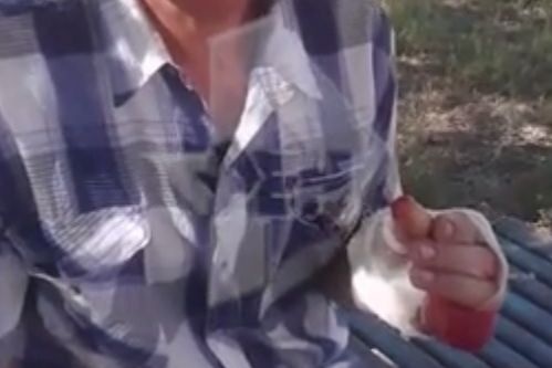 южноуралец отрезал палец следственного произвола 