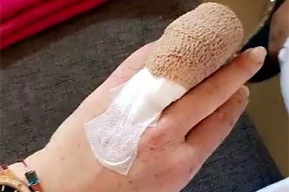  скандальная линдси лохан потеряла половину пальца 