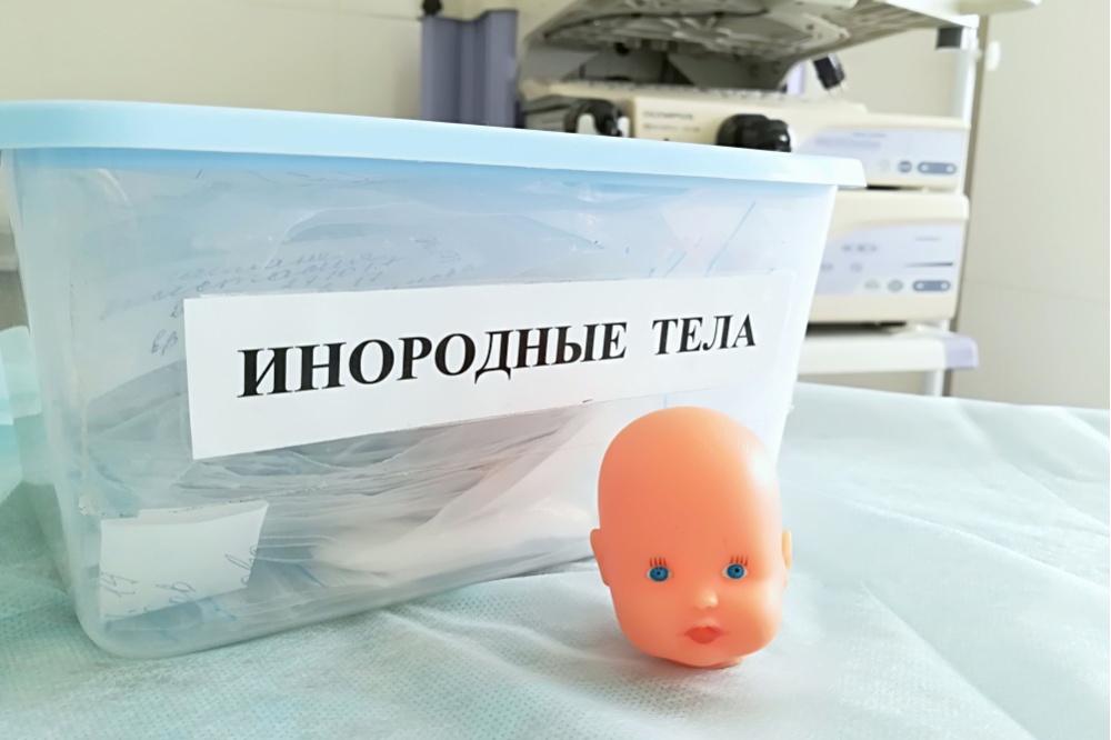  тюменские врачи достали пищевода ребенка 