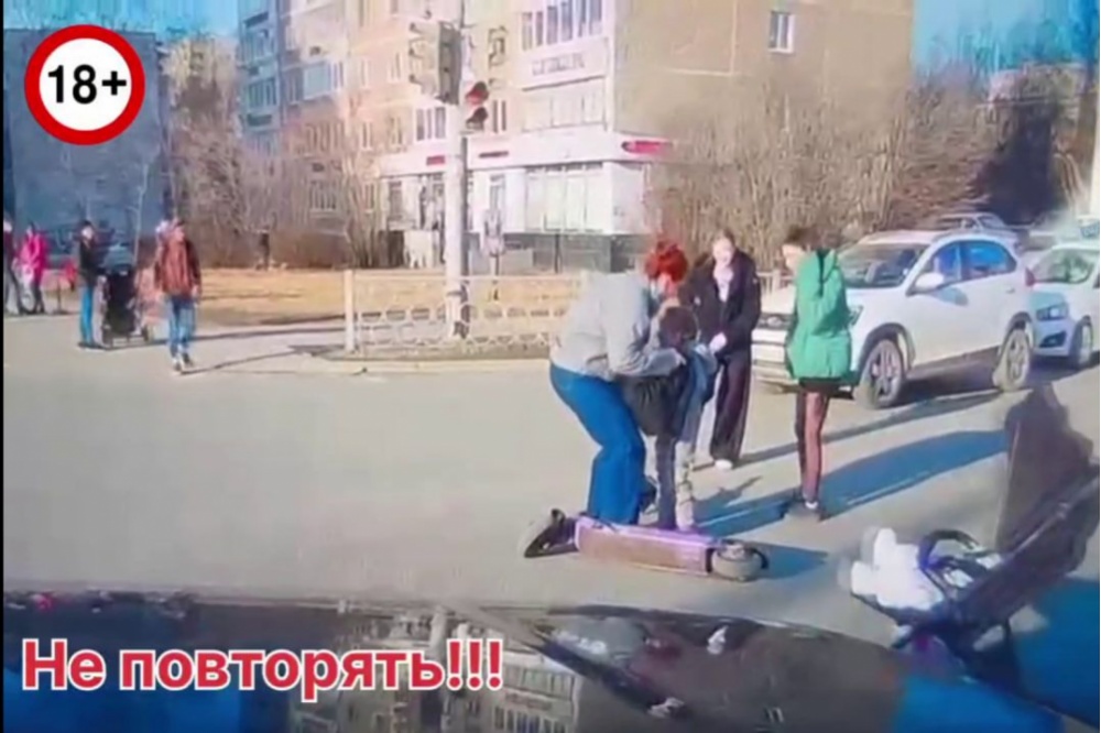  екатеринбурге самокатчицы сбили маленькую девочку ребенка травма головы 